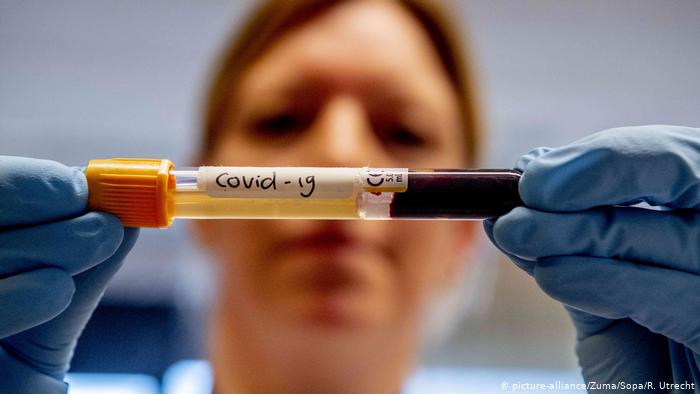 COVID-19 no da tregua a América, supera 134.000 casos y se ensaña con EEUU COVID-19 no da tregua a América, supera 134.000 casos y se ensaña con EEUU