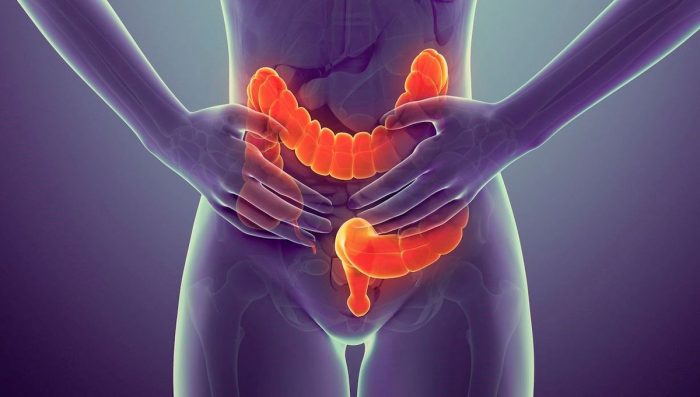 Estrés, sedentarismo y mala alimentación: tres factores que inciden en el colon irritable