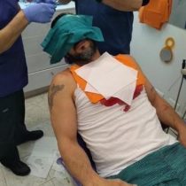 Manifestantes del Rechazo golpearon con bates de béisbol al periodista Rafael Cavada y lanzaron gas pimienta a transeúntes