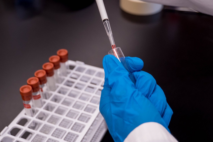 Nueva vacuna contra Covid-19 muestra respuestas inmunes sólidas en todos los participantes en primeros ensayos