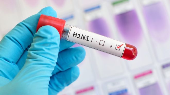Coronavirus: por qué la gripe A-H1N1 no paró la economía mundial como lo está haciendo la pandemia de covid-19 Coronavirus: por qué la gripe A-H1N1 no paró la economía mundial como lo está haciendo la pandemia de covid-19