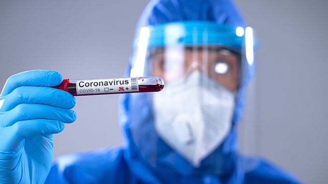 Coronavirus: Qué es el “plasma convaleciente”, el tratamiento con el que algunos hospitales buscan salvarles la vida a pacientes de covid-19 Coronavirus: Qué es el
