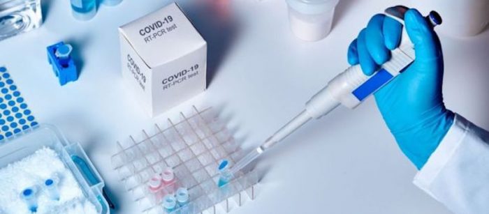 Coronavirus | «No es una creación de laboratorio»: cómo un grupo de científicos logró demostrar el origen natural del virus que causa covid-19 Coronavirus | «No es una creación de laboratorio»: cómo un grupo de científicos logró demostrar el origen natural del virus que causa covid-19