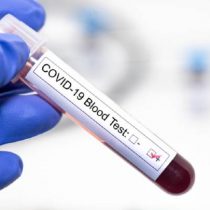 Prueba de anticuerpos: la otra etapa de testeo esencial para combatir el COVID-19