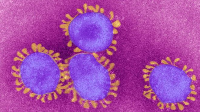 Qué es un virus endémico, en lo que se podría convertir el que causa la covid-19 Qué es un virus endémico, en lo que se podría convertir el que causa la covid-19