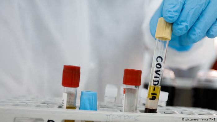 Rusia registra un primer fármaco antiviral contra el COVID-19 Rusia registra un primer fármaco antiviral contra el COVID-19