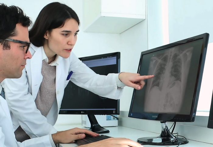 Herramienta gratuita utiliza Inteligencia Artificial para el diagnóstico de Covid-19 en radiografías de tórax Herramienta gratuita utiliza Inteligencia Artificial para el diagnóstico de Covid-19 en radiografías de tórax