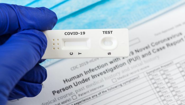 Los test masivos deben estar dirigidos a las personas de riesgo, no a toda la población Los test masivos deben estar dirigidos a las personas de riesgo, no a toda la población