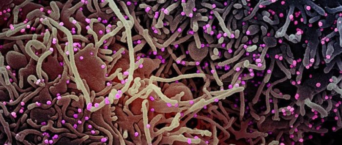 COVID-19 y el lado oscuro de la promiscuidad de la vida COVID-19 y el lado oscuro de la promiscuidad de la vida