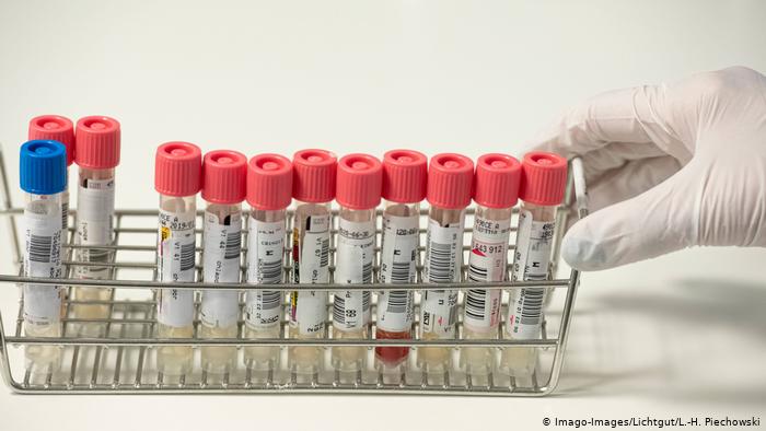 No son perfectos: informe revela que Alemania subestimó la peligrosidad del SARS-CoV-2 No son perfectos: informe revela que Alemania subestimó la peligrosidad del SARS-CoV-2