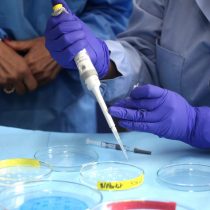 Red de laboratorios públicos llega a su capacidad máxima: Región Metropolitana manda a examinar test PCR a regiones