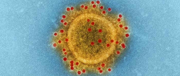 Charla «Lecciones que nos deja la pandemia por COVID19” en UNAB