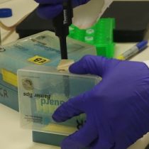 Investigadores esperan desarrollar test para medir infección por COVID-19 con gusano de un milímetro