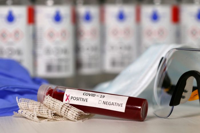 ¿De qué ha servido el estado de catástrofe, el toque de queda? si estamos dentro de la mayores tasas de contagios del mundo ¿De qué ha servido el estado de catástrofe, el toque de queda? si estamos dentro de la mayores tasas de contagios del mundo