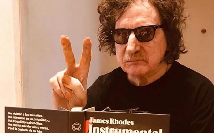 El músico argentino Charly García recibe el alta hospitalaria tras estar internado por un cuadro de fiebre alta El músico argentino Charly García recibe el alta hospitalaria tras estar internado por un cuadro de fiebre alta