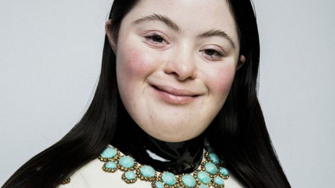 Quién es Ellie Goldstein, la primera modelo con síndrome de Down en aparecer en Vogue Quién es Ellie Goldstein, la primera modelo con síndrome de Down en aparecer en Vogue