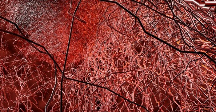 ¿Es COVID-19 una enfermedad vascular? ¿Es COVID-19 una enfermedad vascular?