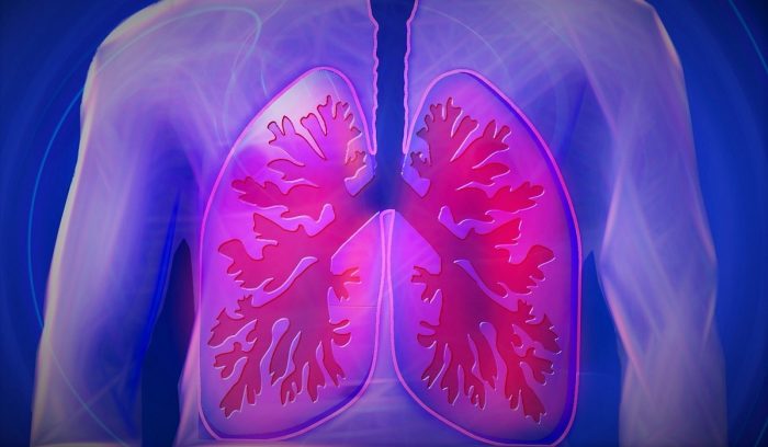 ¿Cuáles son los síntomas para reconocer la Fibrosis Pulmonar Idiopática? ¿Cuáles son los síntomas para reconocer la Fibrosis Pulmonar Idiopática?