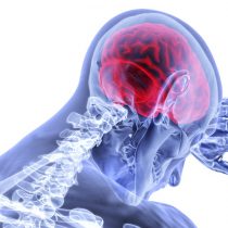 Uno de cada cuatro chilenos no reconoce los síntomas de un ataque cerebrovascular