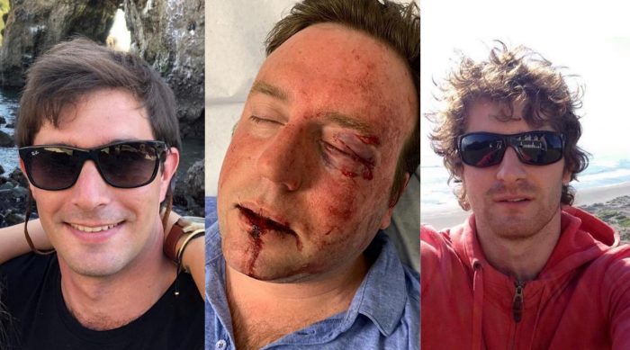 Caso Bulnes: Tribunal deja en prisión preventiva a José Alfonso Bulnes por agresión contra Max Raide Caso Bulnes: Tribunal deja en prisión preventiva a José Alfonso Bulnes por agresión contra Max Raide