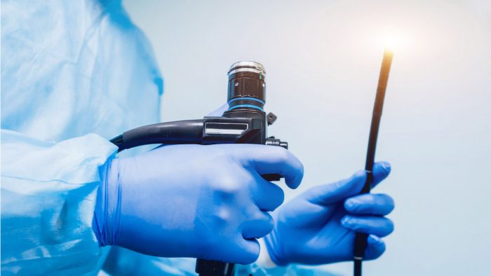 Hacia el año 2030 se proyecta importante aumento de casos de cáncer de colon en Chile Hacia el año 2030 se proyecta importante aumento de casos de cáncer de colon en Chile