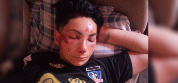 “Te vamos a matar por marimacho”: en ataque lesbofóbico cuatro hombres golpean con un fierro a mujer hasta dejarla inconsciente “Te vamos a matar por marimacho”: en ataque lesbofóbico cuatro hombres golpean con un fierro a mujer hasta dejarla inconsciente