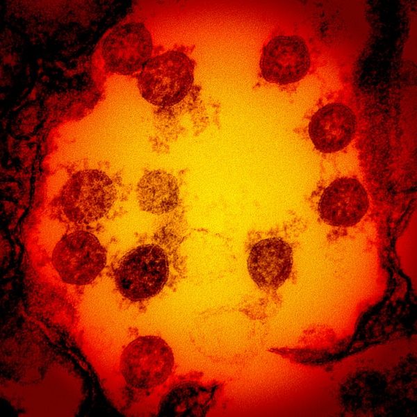 ¿Por qué el coronavirus se propaga ahora con tanta velocidad? ¿Por qué el coronavirus se propaga ahora con tanta velocidad?