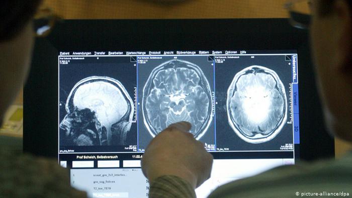 La ayahuasca abre nuevas esperanzas para la cura del Alzheimer La ayahuasca abre nuevas esperanzas para la cura del Alzheimer