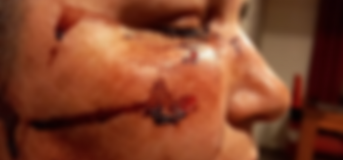 Mujer sufre ataque de lesboodio en Lampa: patearon su cabeza mientras le gritaban “maricona y sucia”