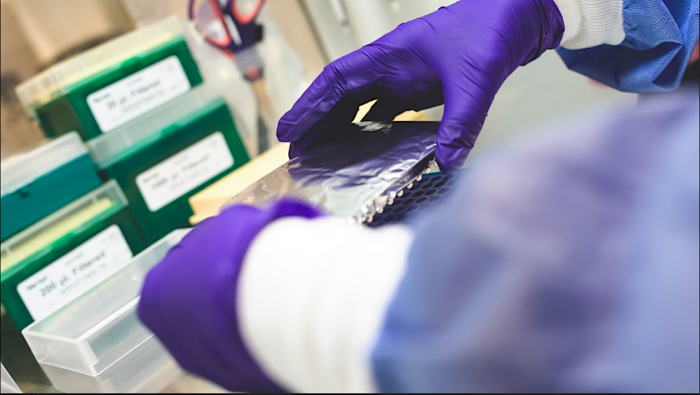 Más de 840 mil PCR han sido analizados por los laboratorios universitarios Más de 840 mil PCR han sido analizados por los laboratorios universitarios