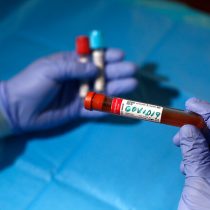 Indicadores de regiones al rojo: informe ICovid insiste en problemas con la trazabilidad y advierte sobre saturación de capacidad hospitalaria