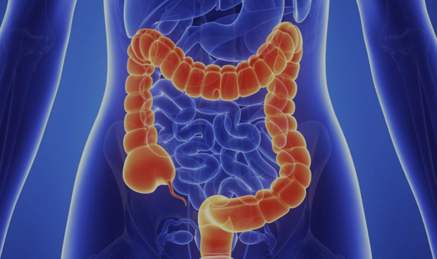 Cáncer de Colon: la necesidad de incorporar estrategias no invasivas de detección en canasta GES Cáncer de Colon: la necesidad de incorporar estrategias no invasivas de detección en canasta GES