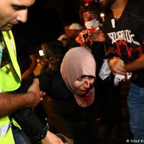 Nueva jornada de violencia en Jerusalén deja más de 90 heridos