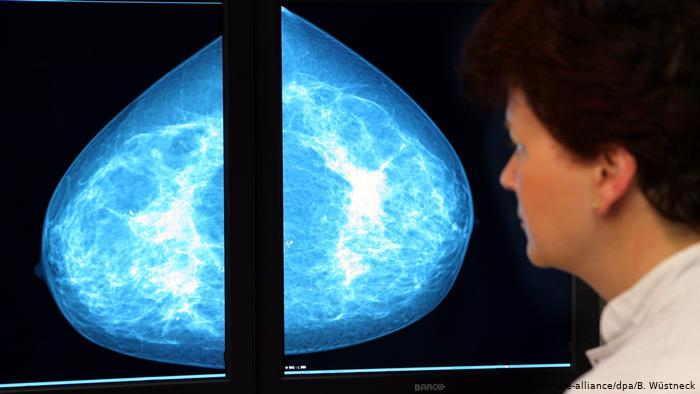 Diagnóstico del cáncer con examen de sangre: ¿es realista? Diagnóstico del cáncer con examen de sangre: ¿es realista?