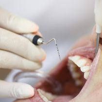 Innovador proyecto de regeneración de la pulpa dental busca darle vitalidad a los dientes