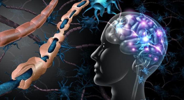 ¿Regeneración en esclerosis múltiple? ¡Sí se puede! ¿Regeneración en esclerosis múltiple? ¡Sí se puede!