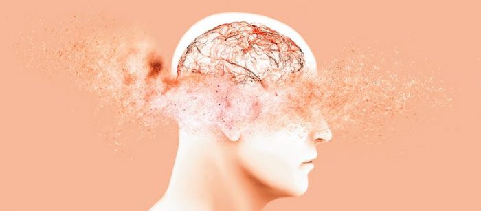 Ocho claves para distinguir el envejecimiento normal del alzhéimer Ocho claves para distinguir el envejecimiento normal del alzhéimer