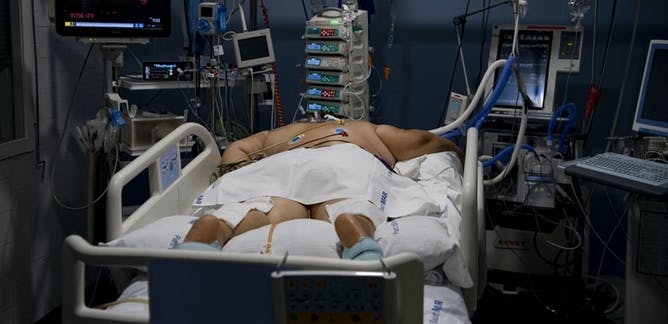 Covid-19: por qué la obesidad es un factor de riesgo Covid-19: por qué la obesidad es un factor de riesgo