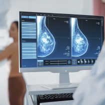 Prueban en Chile algoritmo que permitiría predecir riesgo de cáncer de mamas a través de mamografías