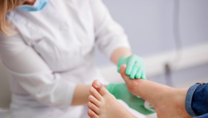 El pie diabético: la principal causa de amputación en el país