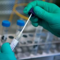 Confirman 29 casos de variante Ómicron en Chile