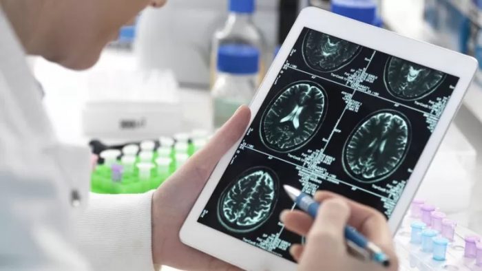 «Parece que perdí puntos de coeficiente intelectual»: la neuróloga que investiga (y sufre) covid de larga duración