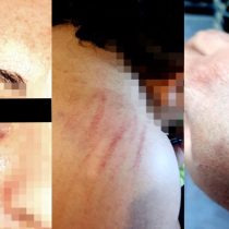 “Mariconas tortilleras”: pareja es golpeada por vecinos dos veces en un ataque por lesbofobia
