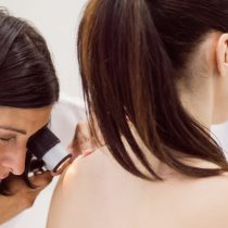 En Chile se diagnostican más de 800 casos de melanoma al año, el cáncer de piel más peligroso