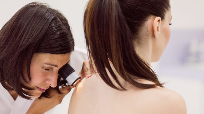 En Chile se diagnostican más de 800 casos de melanoma al año, el cáncer de piel más peligroso