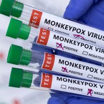 Argentina confirma un segundo caso de viruela de mono