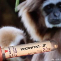 EE.UU. detecta por primera vez dos casos de viruela del mono en niños