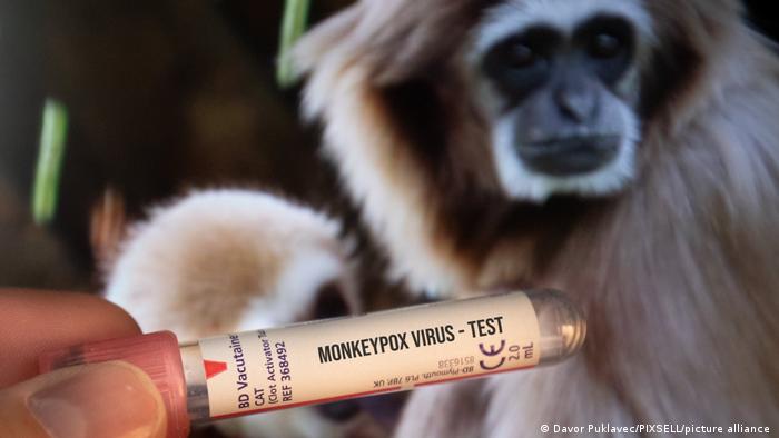 EE.UU. detecta por primera vez dos casos de viruela del mono en niños