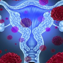''Ni una mujer debería morir por cáncer cervicouterino'': Nosotras Primero