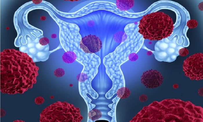 »Ni una mujer debería morir por cáncer cervicouterino»: Nosotras Primero »Ni una mujer debería morir por cáncer cervicouterino»: Nosotras Primero